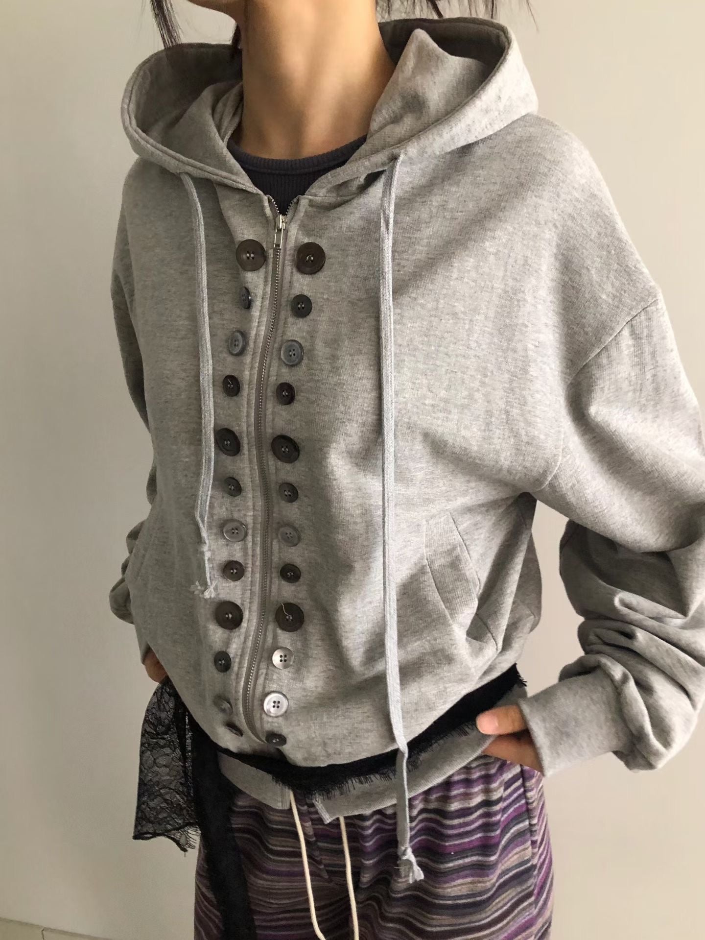 Special button jacket