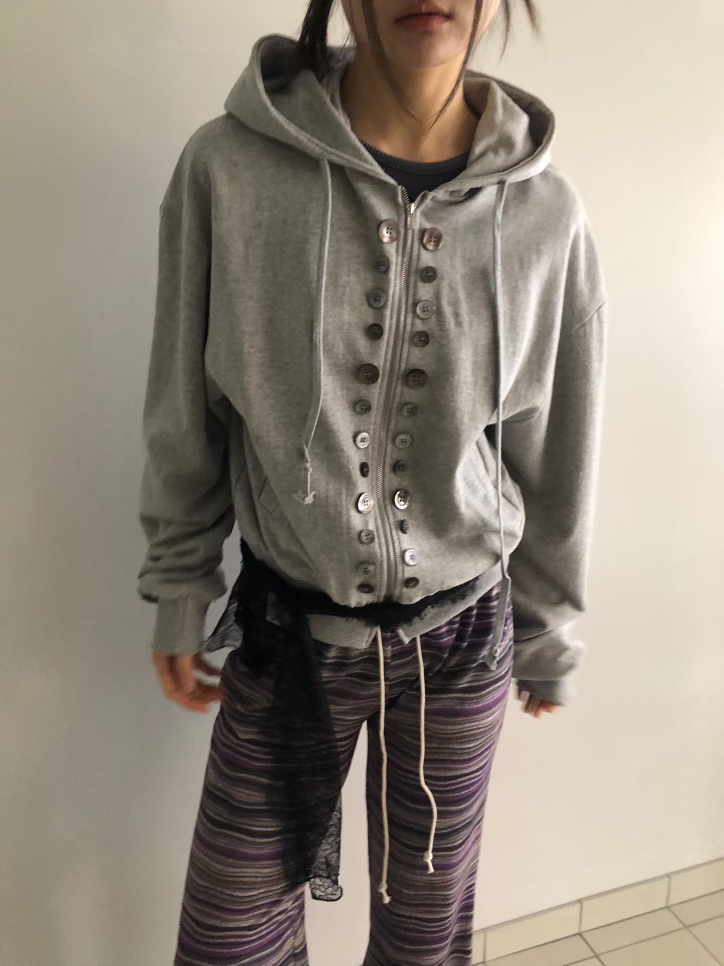 Special button jacket